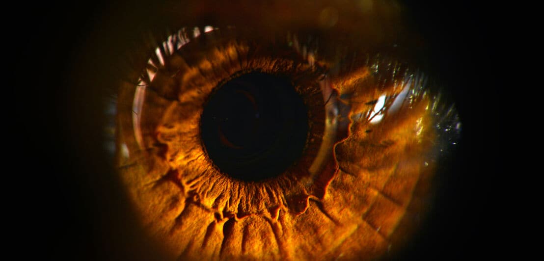 Braune Iris eines Auges vor schwarzem Hintergrund