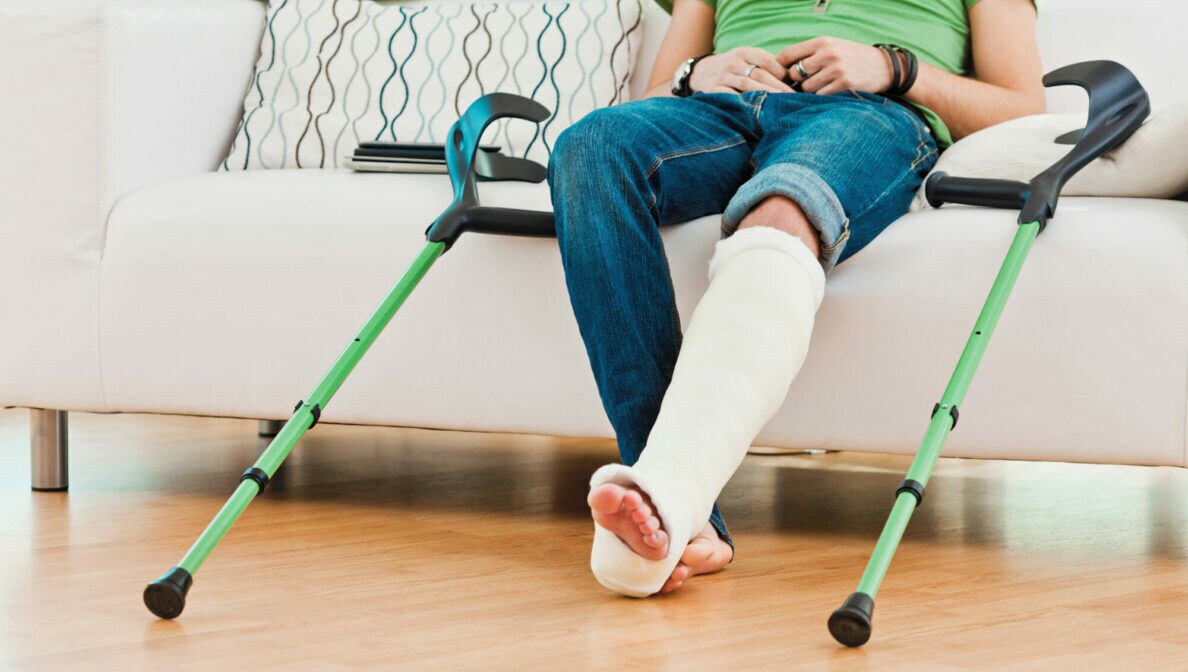 Aufnahme der Beine einer Person, die auf einem Sofa sitzt und ein eingegipstes Bein hat.